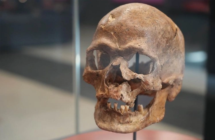 5 bin yıl önce ameliyat edilen kafatası ilgi çekiyor Görseli