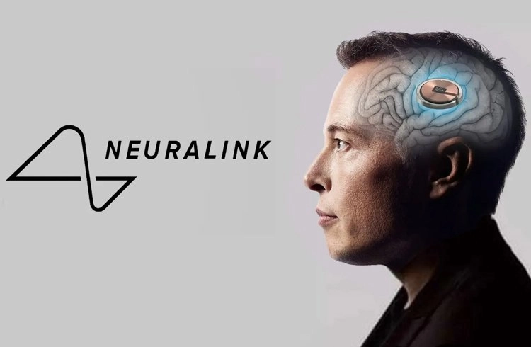 Elon Musk, Neuralink'in beyin çipinin ilk kez bir insana yerleştirildiğini duyurdu Görseli