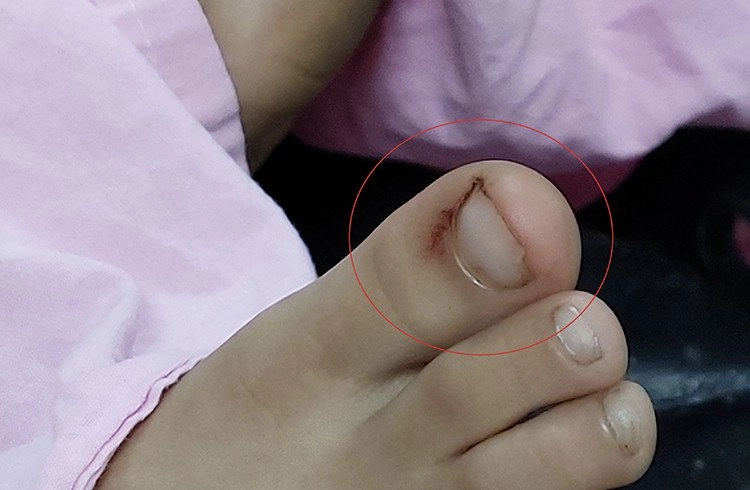 7 Yaşındaki Çocuğun Ayak Parmağını Yılan Soktu Görseli